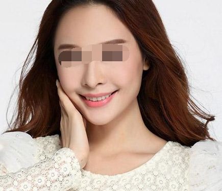 打玻尿酸后可能產(chǎn)生僵硬感？使用玻尿酸有哪些風(fēng)險(xiǎn)？