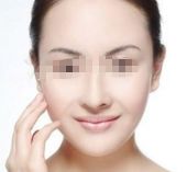 去除眼角魚(yú)尾紋，4個(gè)簡(jiǎn)易方案分享