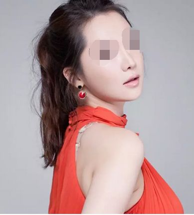 雙眼皮整形術(shù)術(shù)后需要注意些什么？