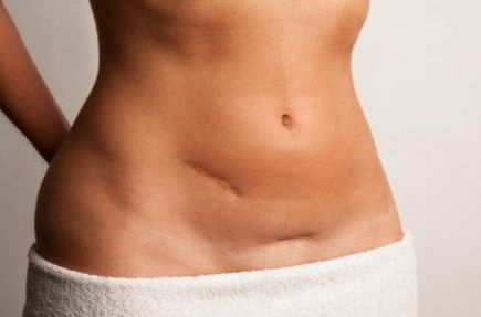 祛眼袋眼紋價(jià)格區(qū)間參考：5千-2萬(wàn)，了解眼袋眼紋治療費(fèi)用