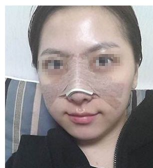 告別私處暗沉！盡顯白皙嬌嫩，激光漂紅來一次就有效果嗎？巧妙俘獲男人的心！