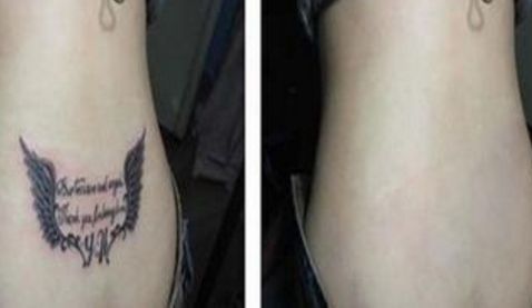 南昌做雙眼皮手術(shù)的價格及手術(shù)效果推薦