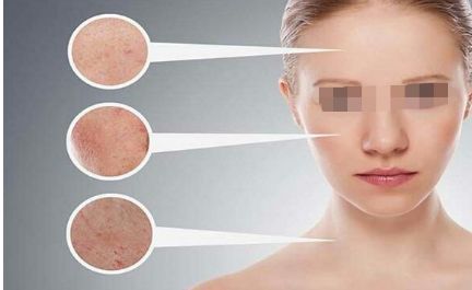 面部填充整形須知曉的注意事項