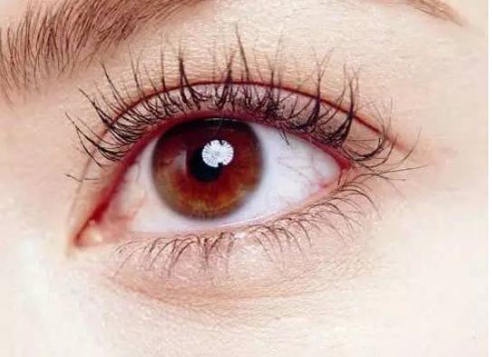 歐洲之星4D與光子嫩膚對比，助你理解抗衰和祛痘效果差異