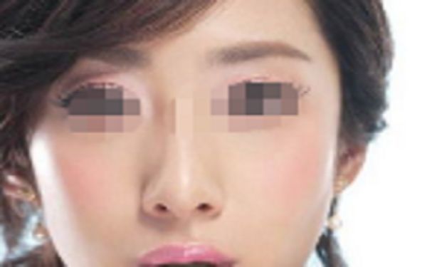 透明質(zhì)酸隆鼻價(jià)格一覽，注射疼痛程度如何？透明質(zhì)酸注射隆鼻價(jià)格分析，疼痛感究竟如何？