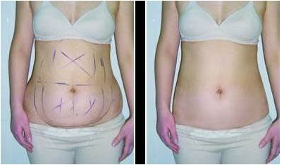 如何鍛煉臀部，打造完美曲線