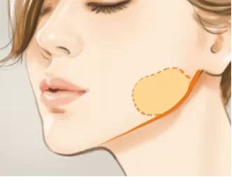 彩光嫩膚：有效去除紅血絲的好方法！