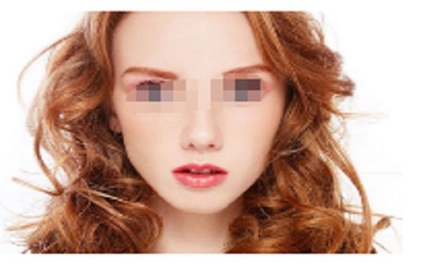 隆鼻修復(fù)重要事項(xiàng)，修復(fù)效果與術(shù)后護(hù)理密不可分！