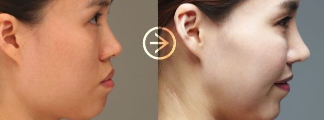 揭秘：讓你的臉型保持完美輪廓的關(guān)鍵！