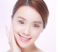 恢復女性魅力，重塑挺翹胸部的矯正方法