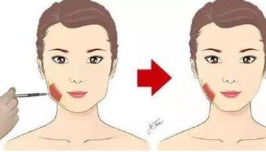 腰部吸脂術的療效如何？