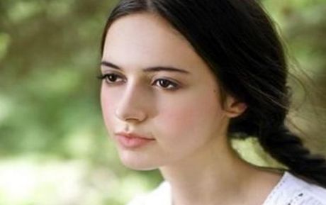 瑞藍麗堤玻尿酸維持效果：維持時間解析及前事必知