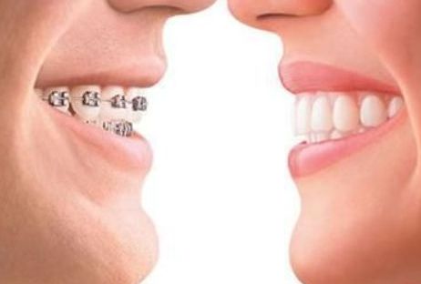 透明質(zhì)酸注射鼻子有沒有過敏現(xiàn)象