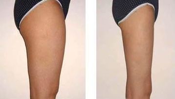 如何有效預(yù)防眼角皺紋，給你的眼部肌膚帶來長久的保護(hù)