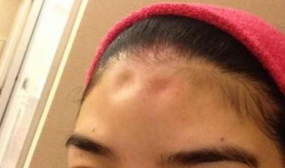 面部輪廓固定多長時(shí)間，價(jià)格和抗衰原理揭秘！