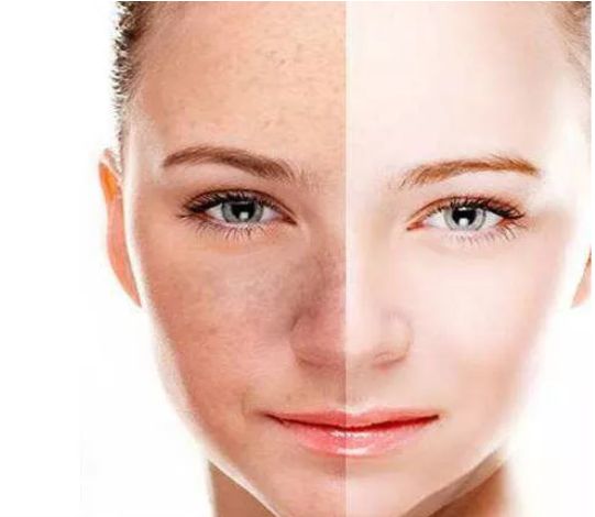 雙眼皮全切手術(shù)前的注意事項有哪些？