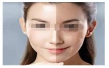 吃海鮮對于使用瘦腿針的人來說是否適合？