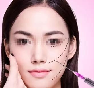 玻尿酸鼻子整形維持時(shí)長與價(jià)格及優(yōu)勢(shì)一覽