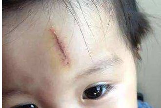 成都哪里做拉皮手術效果好，八大處、晶膚、嬌點等5家備受推薦