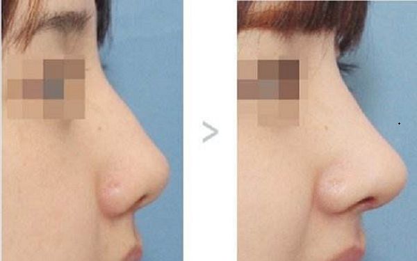 頭皮水光補(bǔ)養(yǎng)秘籍，助你恢復(fù)健康頭皮！