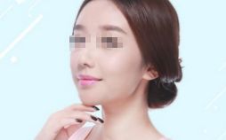 雙眼皮修復(fù)，選對(duì)時(shí)機(jī)，展現(xiàn)美麗眼眸