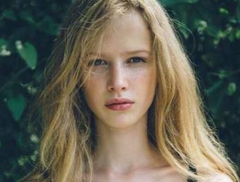 下頜骨整形后應(yīng)該注意什么？