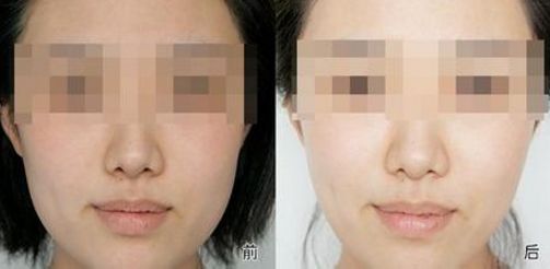 有效改善黑眼圈的飲食和作息調(diào)整方法！