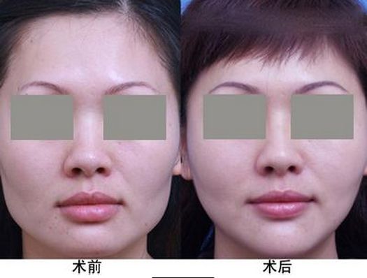 生姜洗發(fā)水哪個牌子好用，一線大品牌值得推薦