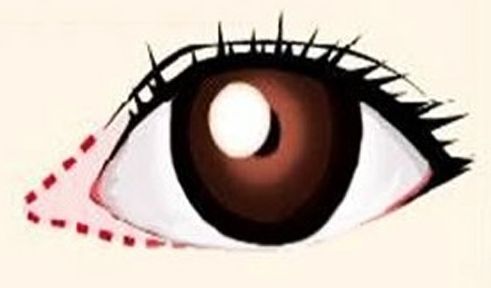 彩光嫩膚祛除紅血絲的效果是否持久？