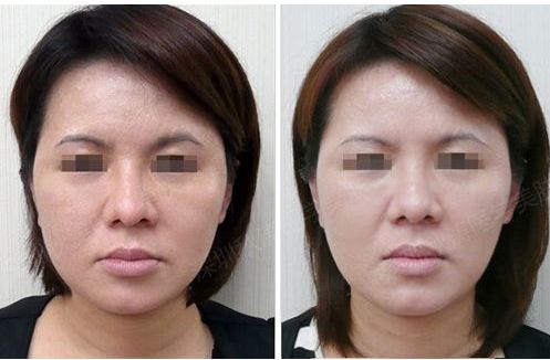 獨家分享：腹部瘦身秘籍及完美護理指南在線解讀