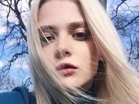 下頜角整形后皮膚松弛有哪些解決辦法？