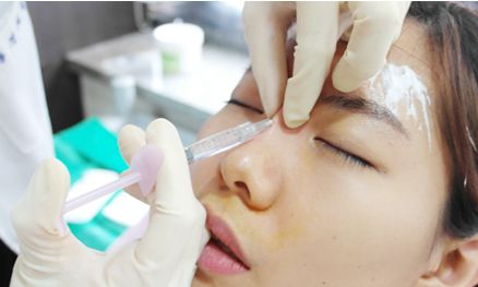 酒糟鼻療法：告別鼻黑洞，重拾光彩肌膚