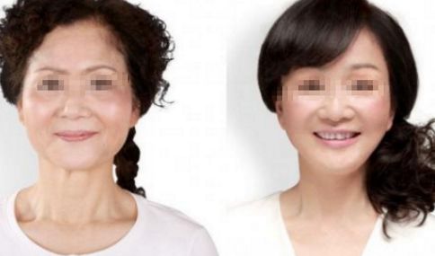 腹部抽脂術(shù)的疼痛感受，了解一下!