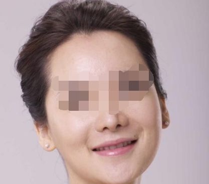 腹部吸脂的獨(dú)特優(yōu)勢(shì)及特點(diǎn)你知多少