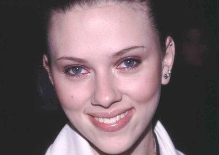 牙齒矯正價格大揭秘！入門價驚喜超預(yù)期，趕緊點開了解吧！