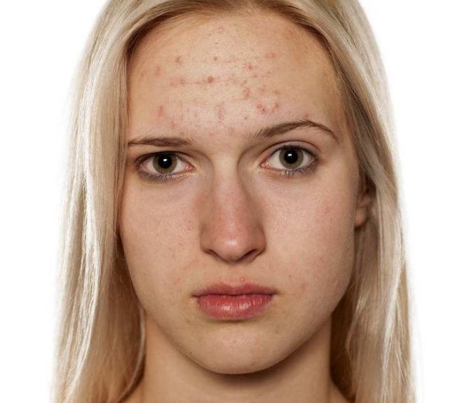 避免隆鼻手術(shù)后遺憾，關(guān)注這些小技巧！