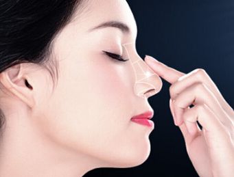 隆鼻手術的效果和感受有哪些