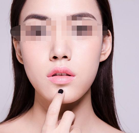 透明質(zhì)酸隆鼻注射后：如何避免過敏癥狀的突發(fā)