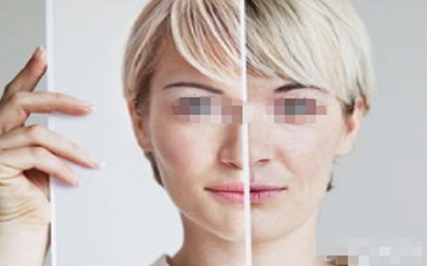 割雙眼皮紋理調(diào)整技巧可改善眼部線條？