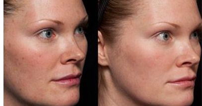 告別小肚腩，打造完美身材的瘦腰神器