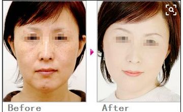 獨(dú)家分享！塌鼻子的完美發(fā)型指南，為你打造精致生活