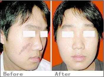 北京鉆石之星醫(yī)療美容真正靠譜嗎？價(jià)格公道嗎？全面價(jià)格表供您參考！