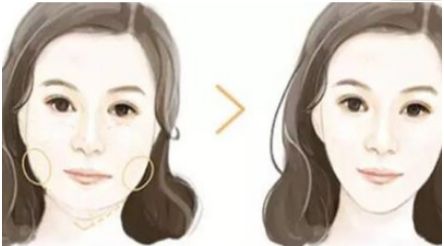 北京激光去眼袋效果維持時(shí)長及價(jià)格