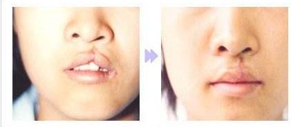 快速瘦身一周十斤，健康有效的飲食與運動方案揭秘！搭配合理，易行又安全