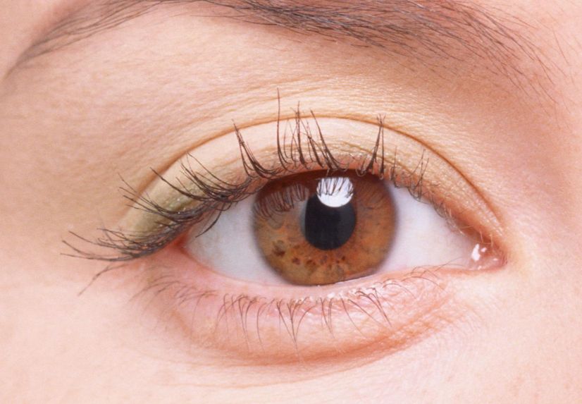 玻尿酸除皺，如何選擇最佳療程