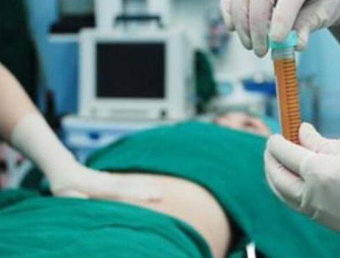 揭秘小眼睛變大神效，眼角拉開簡(jiǎn)單方法曝光！