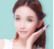 孫儷的容顏變化引發(fā)熱議，她真的進行了整容嗎？