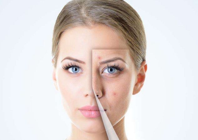 上瞼下垂的修復(fù)技巧：展現(xiàn)年輕神采和自信