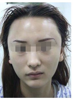 腰腹瘦身術(shù)對(duì)于塑造體形的有效性