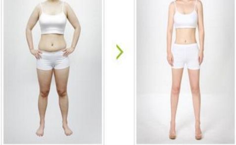 陰道緊縮術(shù)的持久效果及保持時(shí)長(zhǎng)